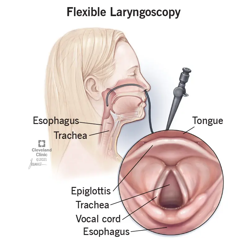 Flexible Endoscopic Laryngoscopy