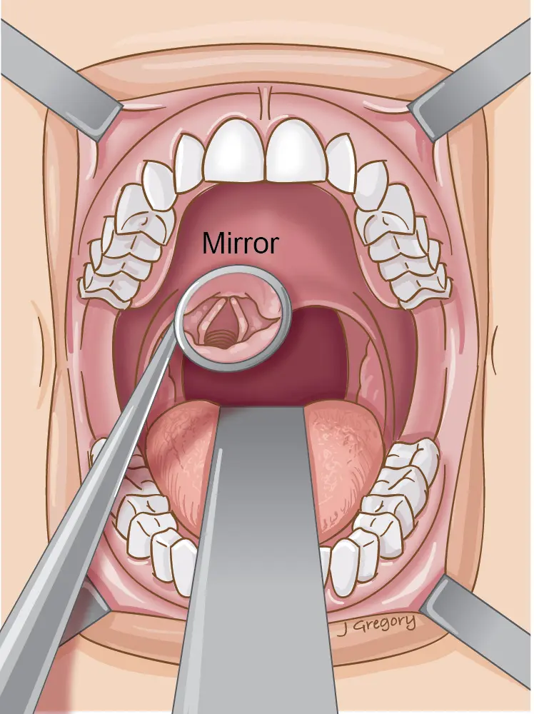 Pharyngoscopy